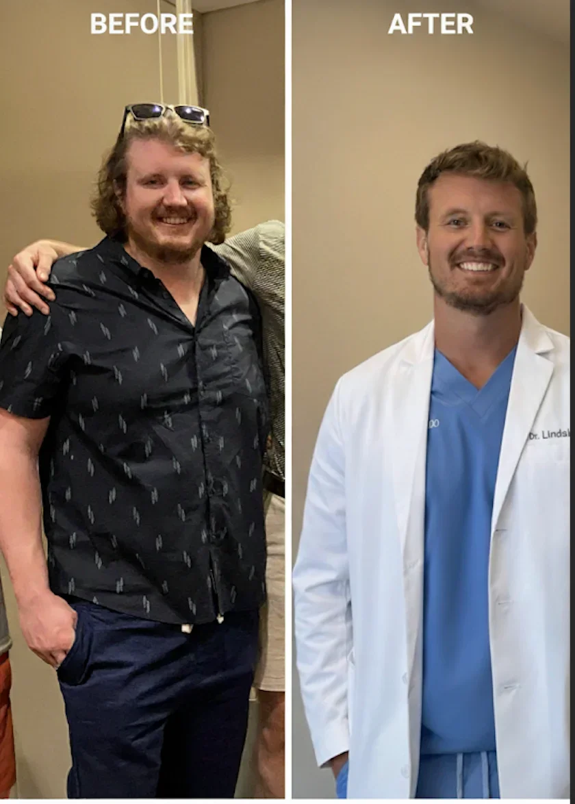 Dr. Josh Lindsley before and after weight loss transformation
